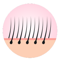 hair-follicle